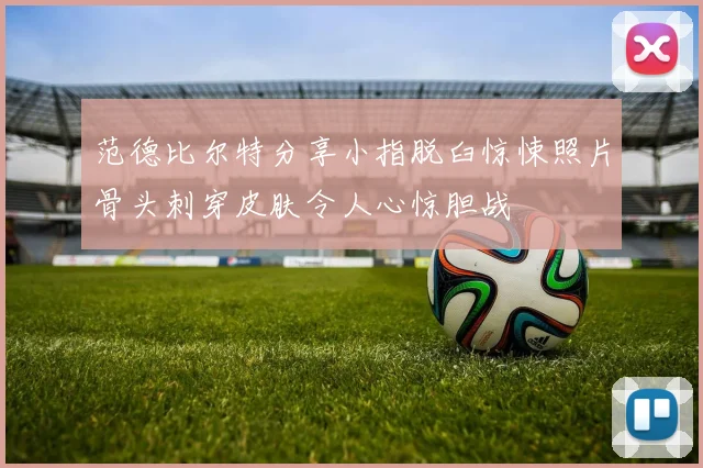 范德比尔特分享小指脱臼惊悚照片骨头刺穿皮肤令人心惊胆战